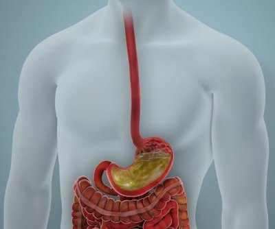 Ozempic, new intestinal therapy may eliminate need for insulin in Type 2 diabetics